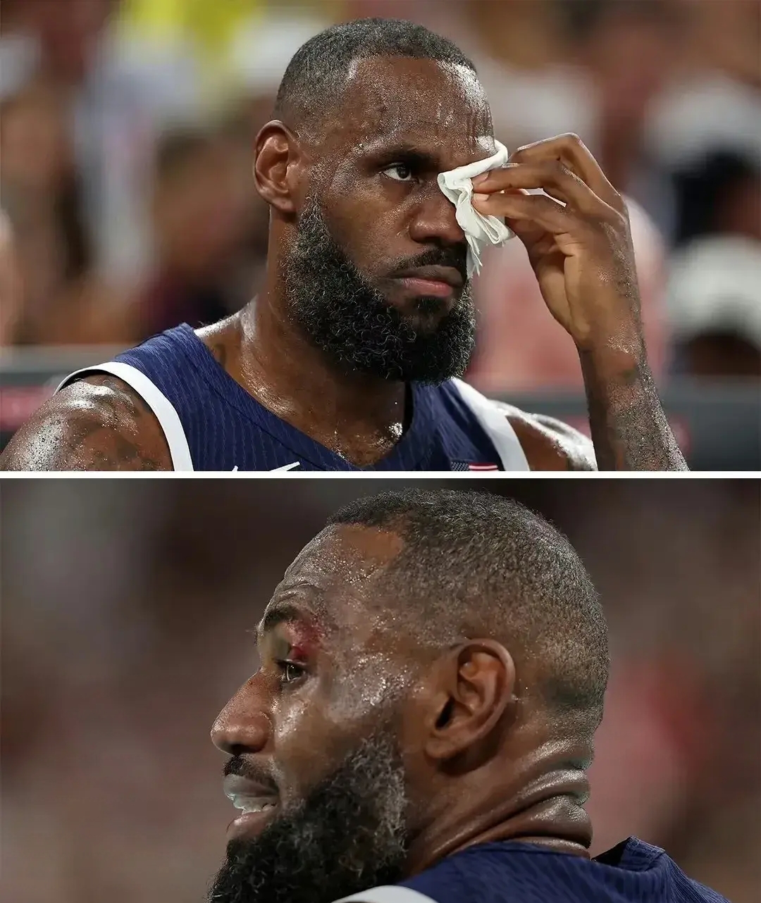 比赛中的惊险一幕引发球迷不断热议的简单介绍 比赛中的惊险一幕引发球迷不断热议的简单介绍